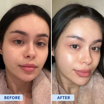Bodywise Glycolic Acid Exfoliating Body Stick | 7% Glycolic Acid with Shea Butter & Jojoba Oil | Exfoliates, Hydrates & Evens Skin Tone for KP, Acne, Pigmentation & Rough Skin