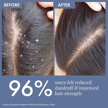 BBlunt Intense Moisture Lamellar Treatment Water | 8-Second In-Shower Hair Transformation with Jojoba & Vitamin E | Frizz Control, Deep Hydration & Shine