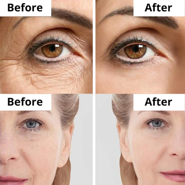 Highfy Beauty Retinol 0.5% Serum | Anti-Aging & Anti-Acne Formula with Natural Oils | Reduces Wrinkles, Fades Dark Spots & Brightens Skin