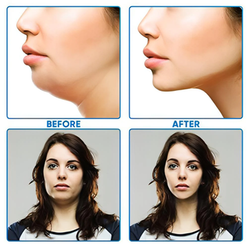Bioheal Face Lifting Mask | Reduces Sagging, Double Chin, Wrinkles & Smile Lines | Visible Results in 30 Minutes